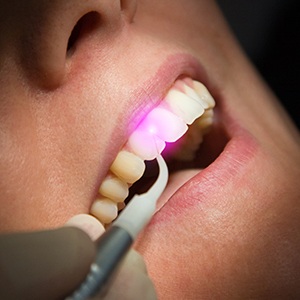 periodontal cleanings