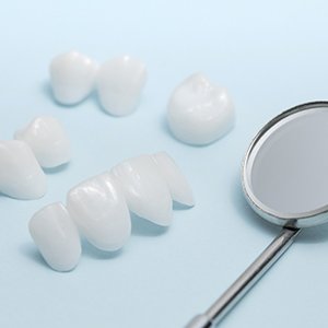 Dental bridges and crowns for full mouth reconstruction. 